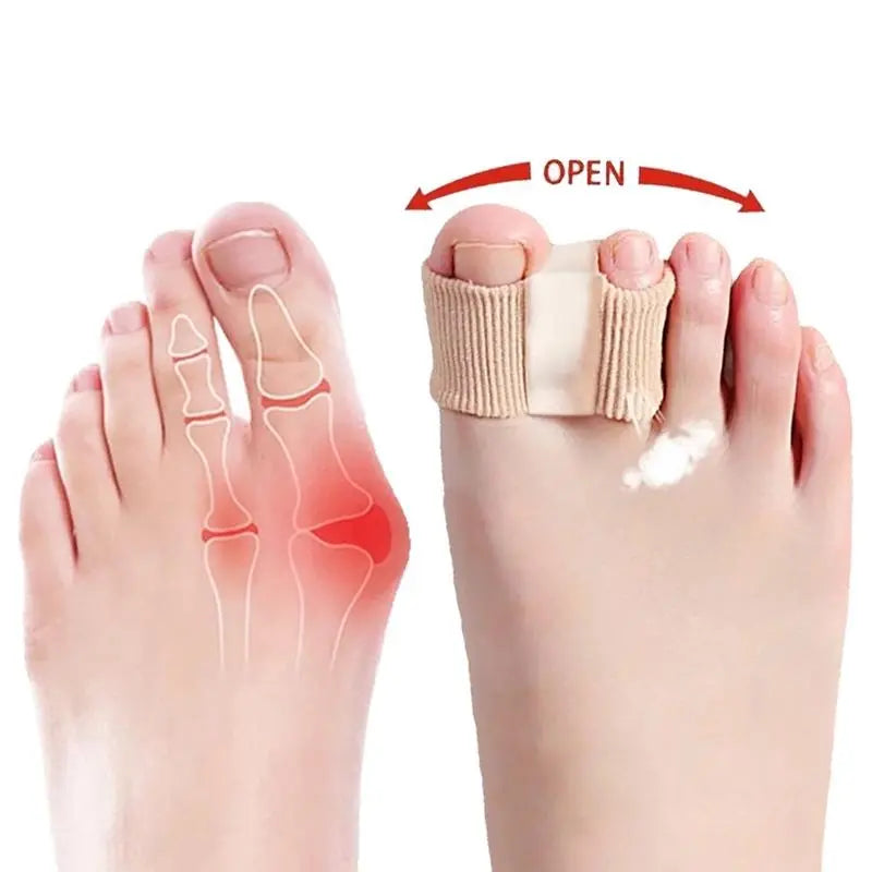 Silicone Toe Separators for Bunion Relief by Springtok - All-Day Comfort for Walking, Running, and Hiking | Bunion Corrector and Toe Sleeves Healthcare