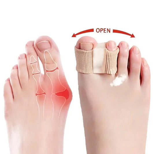 Silicone Toe Separators for Bunion Relief by Springtok - All-Day Comfort for Walking, Running, and Hiking | Bunion Corrector and Toe Sleeves Healthcare
